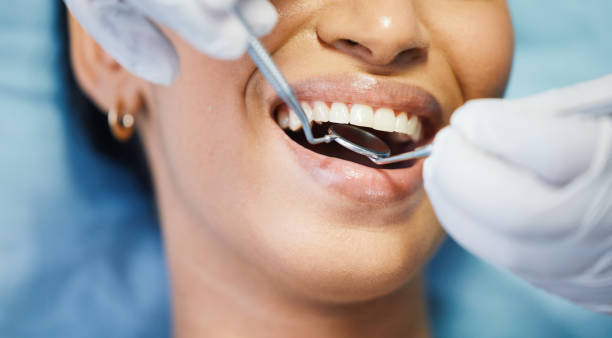 Best Broken or Cracked Tooth Emergency Dentist in Oak Ridge North, TX