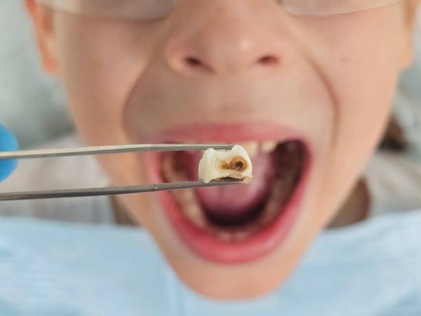 Best Emergency Dental Services for Seniors in Oak Ridge North, TX